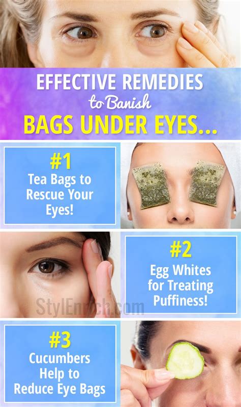 under eye bags remedy